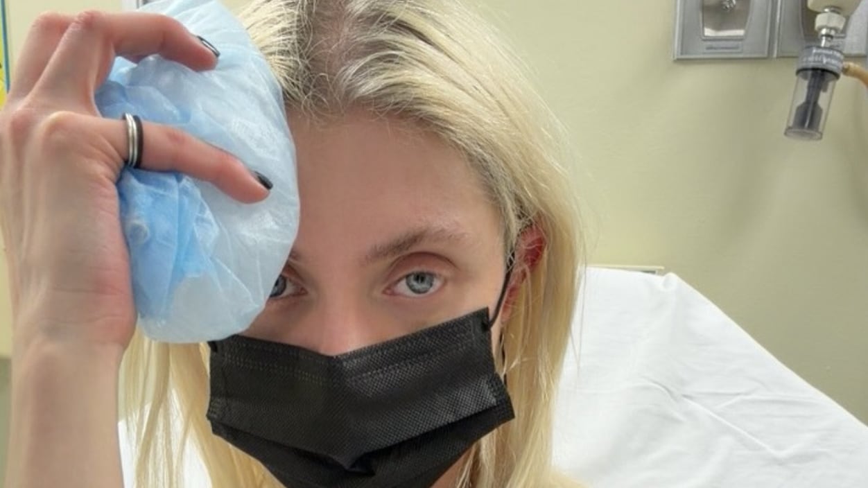 Taylor Momsen Hospitalized One Week After Venomous Spider Bite